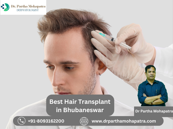 Best Hair Transplant in Bhubaneswar  Dr Partha Mohapatra - Delhi - Delhi ID1563236