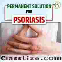 Natural remedy for scalp psoriasis treatment