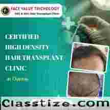 High Density Hair Transplant Clinic in Chennai