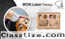 Non-Surgical Skin Tightening with MOXI Laser in New York