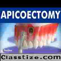 Best apicoectomy treatment in Dubai UAE