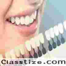 Best Cosmetic dentistry clinic in Dubai UAE