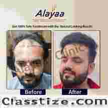 How to Choose a Hair Transplant Specialist in Chandigarh