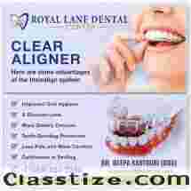 Clear Aligners in Dallas