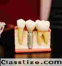 Premier Dental Implant Center in Kolkata