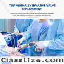 Top Minimally Invasive Valve Replacement