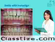 Best Invisalign Doctor in Sarjapur Road, Bangalore