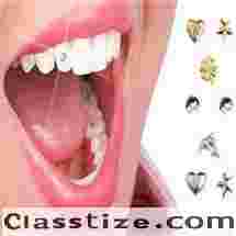 Best Dental jewellery treatment clinic in Dubai UAE