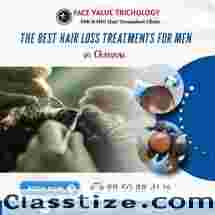 Hair Transplant Surgery Doctors In Chennai