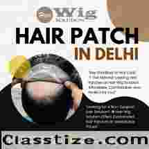 Affordable Hair Patch in Delhi – Hair Wig Solution